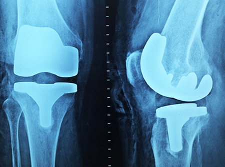 Orthopädische Chirurgie Orthopädische Chirurgie