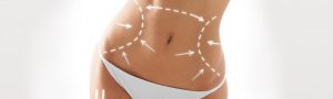 Cosmetic surgery for women (Body)