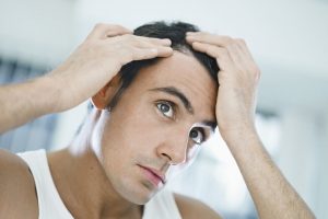 Greffe cheveux Homme