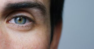 greffe de sourcils